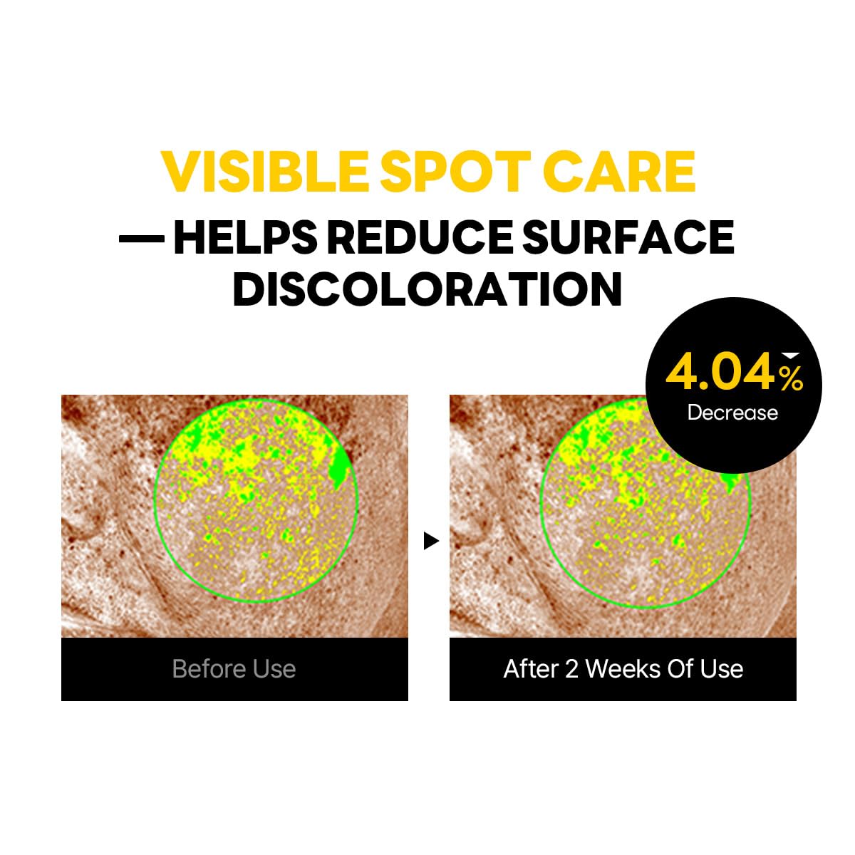 ROUND LAB Vita Niacinamide Dark Spot Cream 1.69 Fl Oz, Tone Clarity Moisturizer with Tranexamic Acid, and Vitamin Complex for Dark Spot Care, Uneven Skin Texture, and Skin Radiance, Korean Skincare