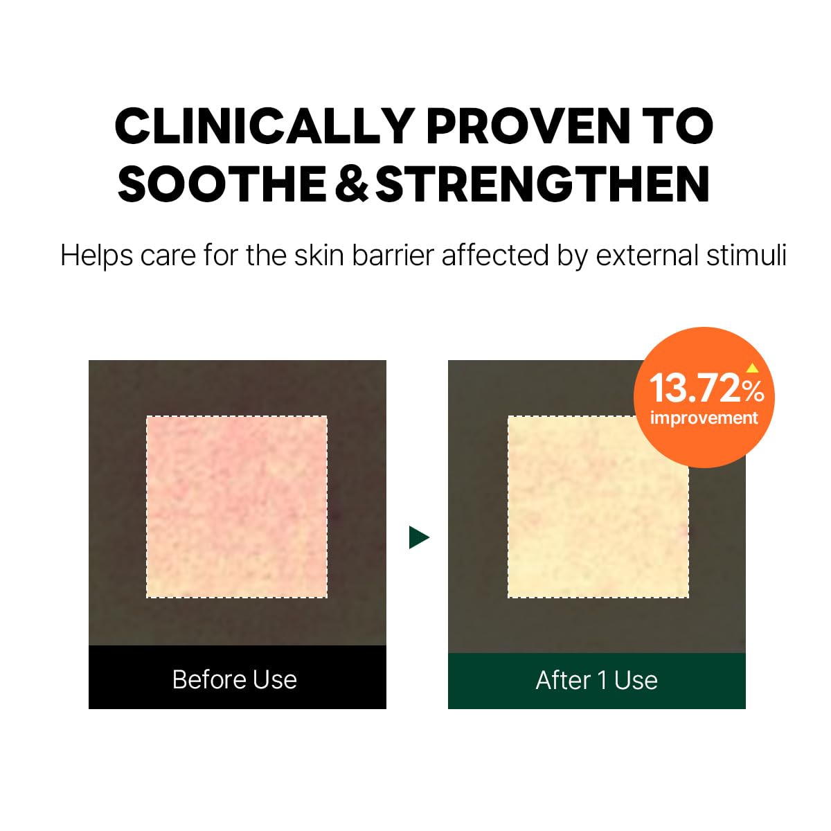 ROUND LAB Pine Cica Calming Cream Plus 60ml – Dual-Texture Soothing Cream for Blemish Care, Acne-Prone Skin Safe, Sebum & Oil Control, Intensive Calming, Strengthens Skin Barrier, Clear & Calm Finish