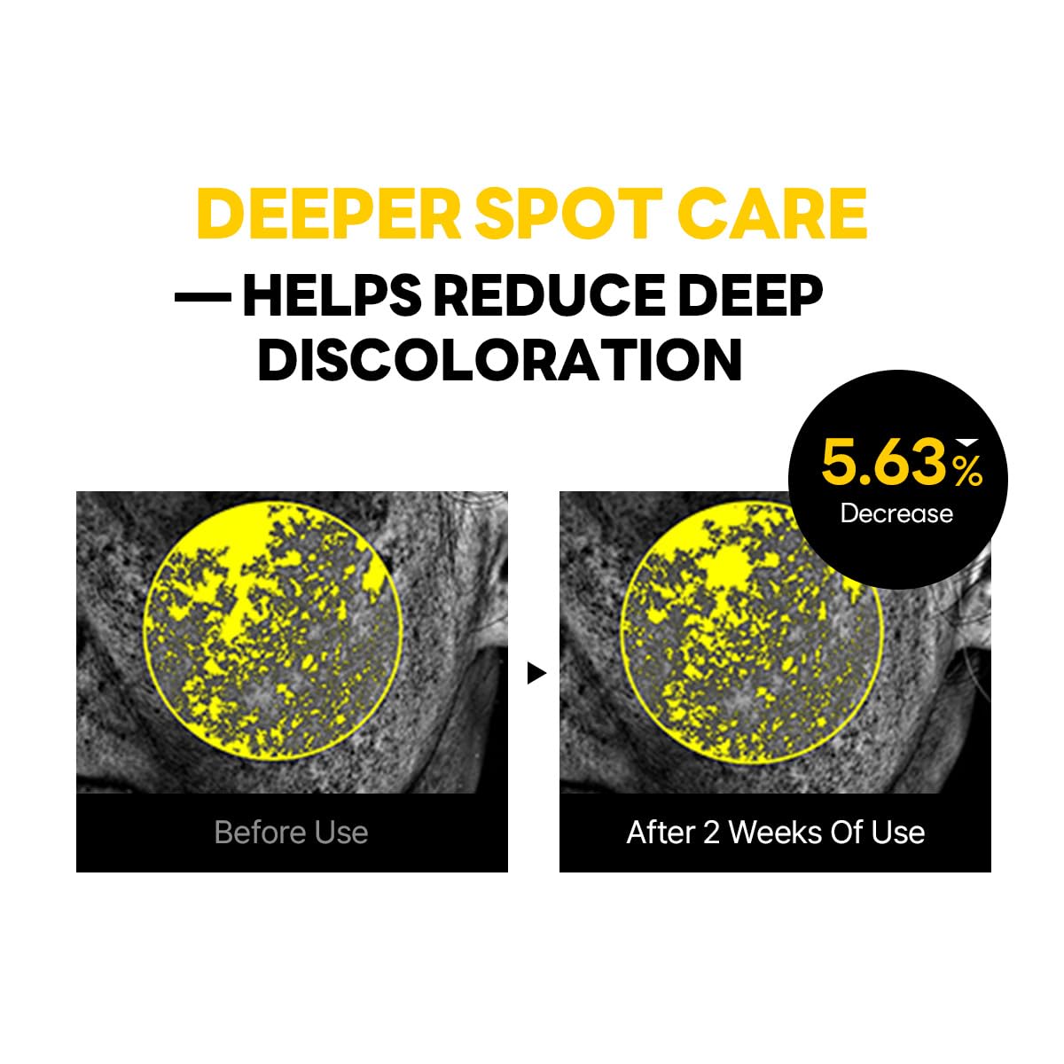 ROUND LAB Vita Niacinamide Dark Spot Cream 1.69 Fl Oz, Tone Clarity Moisturizer with Tranexamic Acid, and Vitamin Complex for Dark Spot Care, Uneven Skin Texture, and Skin Radiance, Korean Skincare