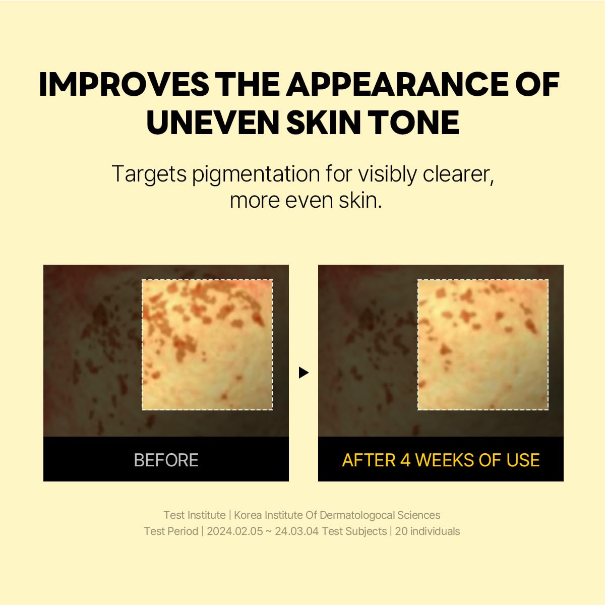 ROUND LAB Vita Niacinamide Dark Spot Serum 1.01 Fl Oz, Radiance-Boosting and Dark Spot Correcting Face Serum with Vitamin C, Improves Uneven Skin Tone, and Enhances Skin Clarity, Korean Skincare